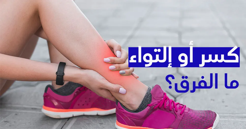 كسر أو التواء ما الفرق